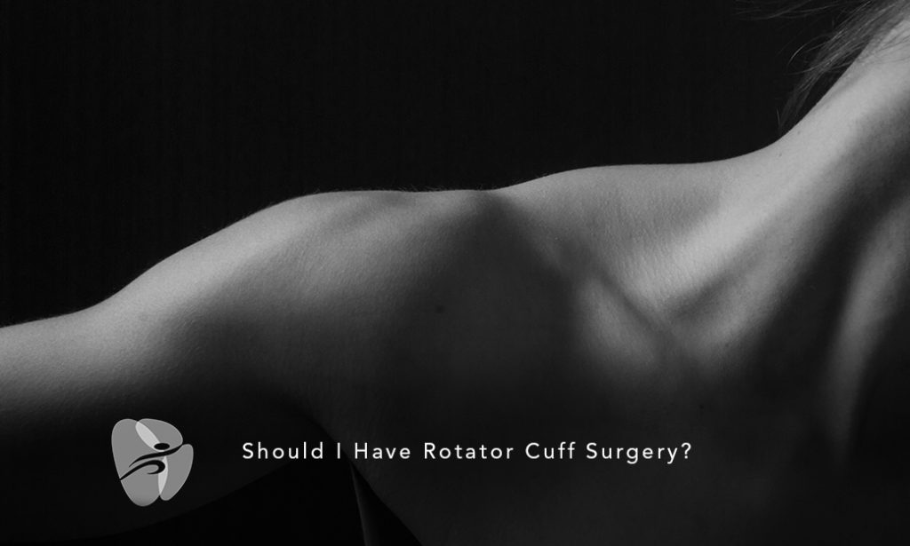 Should I Have Rotator Cuff Surgery?